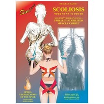 [scoliosis] 측만증을 위한 척추 나선 안정화 운동책 Scoliosis