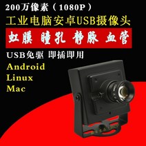 열화상 카메라 적외선 안면 인식 열감지카메라 1080p 적외선 인간의 눈 홍채 동공 정맥 혈관 인식 안드로이드 산업용 카메라 왜곡 없음 usb 카메라, LED 조명 제어(표시할 초점 거리 메시지)