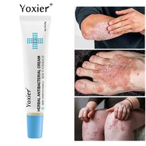 yoxier 허브 항균 크림 건선 크림 가려움증 완화 습진 피부 발진 두드러기 박리 치료 건선 피부건선 한포진 모낭염 연고 가려움증 간지러움 약 지루성피부염 치료 연고 타박상, 보여진 바와 같이, 협력사