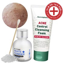 시크릿플랜트 아크네 컨트롤 티트리 여드름 클렌징폼+ AC 퓨어 스팟 화이트 파우더, 1set