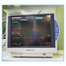 환자감시장치 심전도 측정기 가정용 소형 모니터 차트, 1개