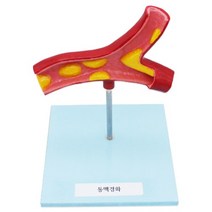 동맥경화 혈관모형
