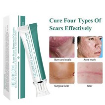 흉터연고 상처 흉터 연고 화상흉터연고 수술 흉터 연고 제왕절개 흉터연고 여드름 흉터 연고, 30ml, 3개
