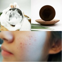 [오후5시 당일발송] 고농축 어성초 비누 청소년 얼굴 몸 어성초 저자극 여드름비누 모낭 세안비누 좁쌀 비누 농축어성초비누 세수비누 YB맘, 1개, 100g