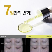 [7일만의 효과] 키오스킨 잡티 주근깨 흔적 케어 기미 앰플 화이트닝 미백 에센스 앰플 10ml 3개입, 3개