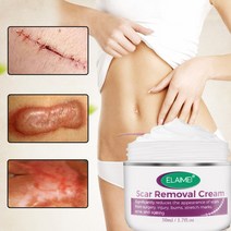 [당일배송] ELAIMEI 흉터제거연고 병에 담긴 흉터 관리 수술 상처 치료, 50g × 1개
