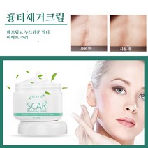 EELHOE 흠집제거 카페인트 흉터제거연고 피부 흉터 치료 켈로이드성 화상 흉터, 30ml × 3