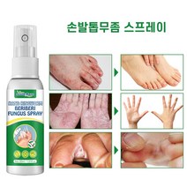 손 발 이끼 무좀 스프레이 손발톱 무좀치료 발냄새제거 발각질무좀 연고, 30ml, 1개