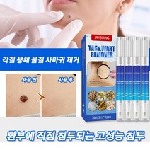 jaysuing 편평사마귀 사마귀치료 얼굴 사마귀 신속하고 효과적인 사마귀 제거