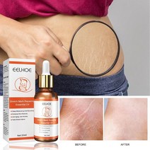 스트레치 마크 수리 에센셜 오일 스킨 케어 트리트먼트 크림 임산부 리무버 안티 링클 슬랙라인 임산부 오일 20ml