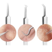 피지 제거기 여드름 짜는도구 짜기 코 얼굴 블랙헤드 압출 바늘 집게 짜개 피부과 압출기, 일자형, a>상품선택<z