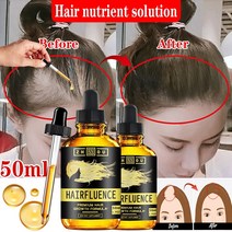 탈모예방 여성탈모 남자탈모 남성탈모 모근강화 발모 모발 탈모 탈모방지 샴푸 기능성 탈모기능성 탈모샴푸순위 헤어토닉 헤어에센스 헤어오일, b-0035-30ml