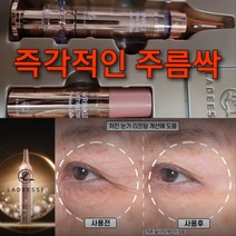 AHC 앰플 or 즉각 주름 보톡세럼(본품+리필) or 아이크림 1+1선택, 즉각 주름 보톡세럼(본품+리필)1+1세트