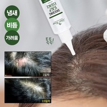 쇼킹 두피 에센스 6세트 / 머리 냄새 비듬 가려움 케어 관리, 단품