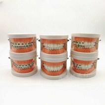치과실습 치과의사 치위생 교육용 구강 시뮬레이션, 아치 와이어 포함 하프 메탈 하프 세라믹 모델