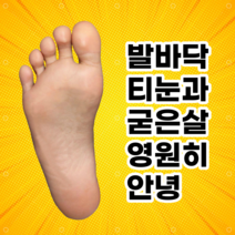 CB40 티눈깔창 발바닥 굳은살 제거, 275~280, 블루 혹은 그레이 랜덤