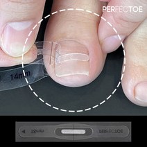 [특허청 실용신안 등록] 퍼펙토 내성발톱 교정기 자가치료 세트, 14mm 스트립