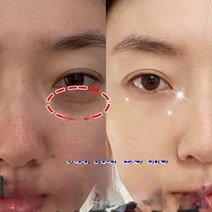 뷰티아이 백 아티팩트 남성용 에센스 다크 서클 패치 링 오일 여성 마스크, 한개옵션1, 03 420g