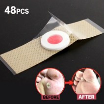 발바닥 티눈 밴드 약 제거 48 개대 발 관리 스티커 의료 석고 닭 눈 패치 의료 석고 발 제거, 48개