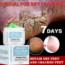 풋크림 발크림 안티 드라이 핸드 및 크랙 힐 갈라진 필링 리페어 핸드 및 필링 및, 50 그램