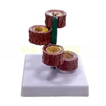 인체 혈관 모형 지맥 혈전 심혈관 질병 교육 설명자료, 4척 4절혈관