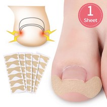 내성발톱테이프 교정 내성발톱 치료 내성 발톱 교정기 스티커 페디큐어 도구 20-4 개 발 관리 복구, 06 6Pcs G179, 6Pcs G179