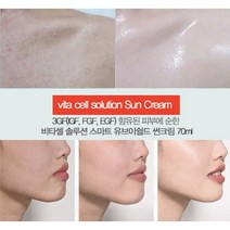 특허 기미제로크림 100g/색소침착 기미 잡티 특허, 특가4)재생선크림1+줄기세포 마스크팩 1매