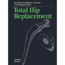 Total Hip Replacement Paperback, Springer