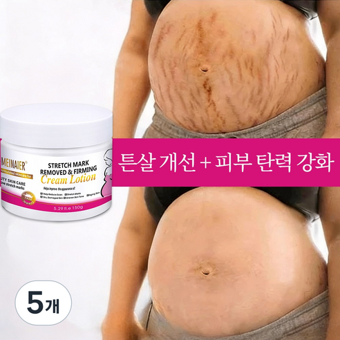 임신 크림 Stretch Mark Cream 임신부 바디 로션 산후 크림, 5개, 150g