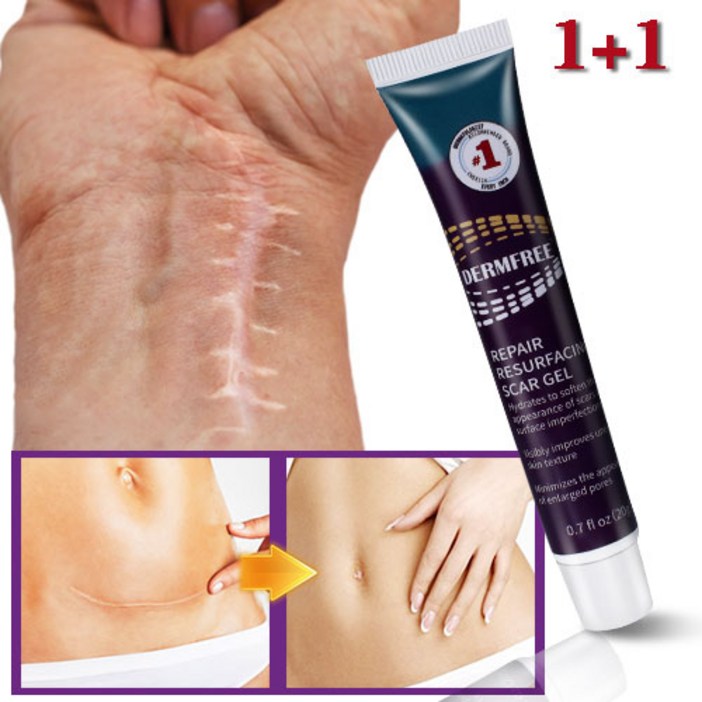 DERMFREE 흉터연고 여드름흉터 수술흉터 화상물집  쌍꺼풀흉터 제왕절개흉터  흉터제거연고 재생크림