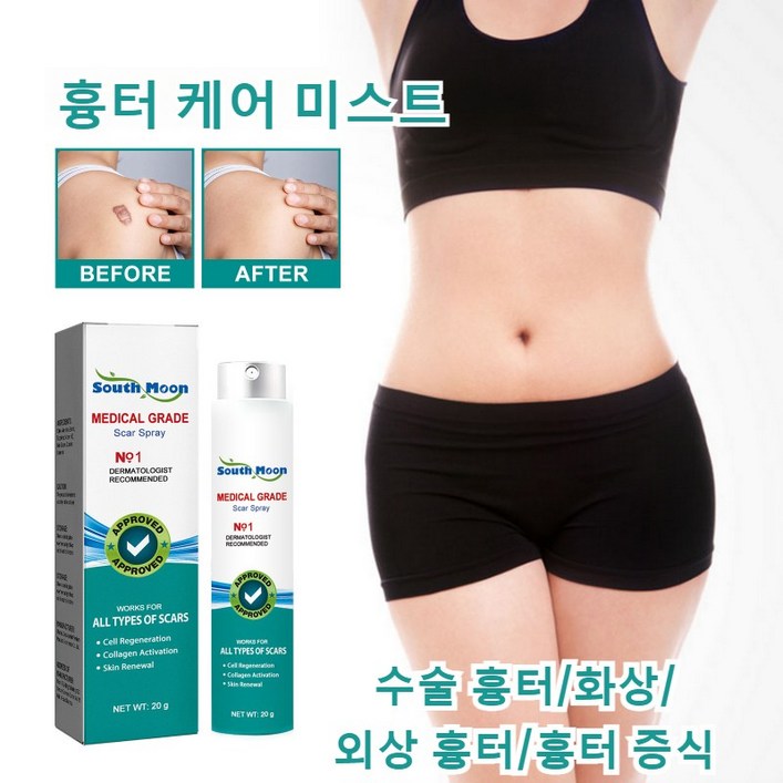 흉터 케어 미스트 수술흉터 화상물집 쌍꺼풀흉터 제왕절개흉터 흉터제거연고 재생크림 과민성 흉터흉터 증식, 5개, 20g