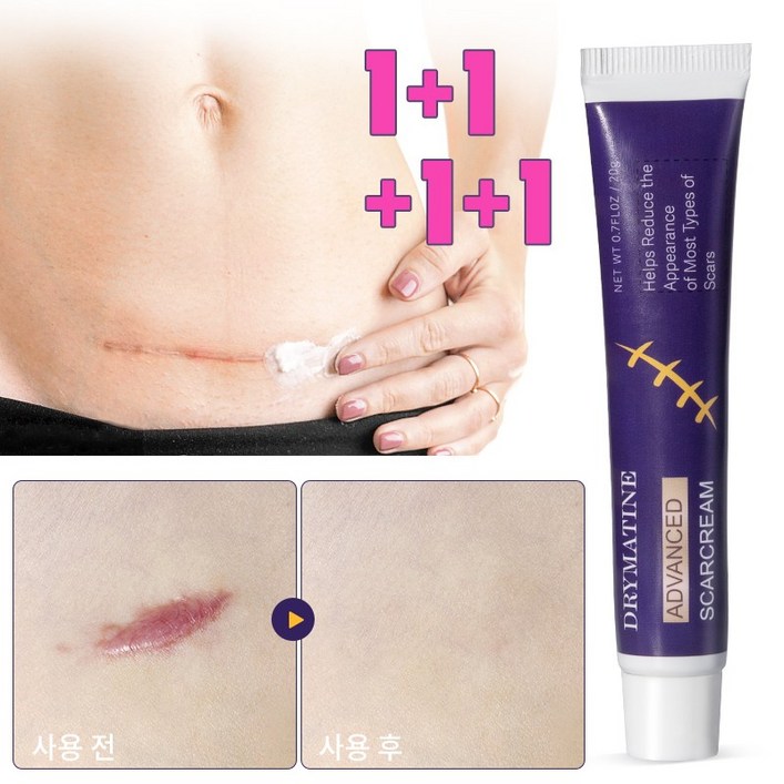 당일배송 DRYMATINE 흉터연고 흉터제거연고 재생크림 상처흉터연고 여드름흉터 수술흉터 화상물집 흉터제거연고, 4개, 20ml