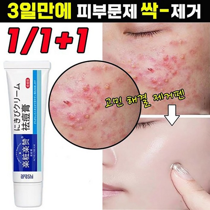 국내배송 일본 여드름 연고 흉터 제거 연고 색소침착 피부 수본 미백 재생 크림 포장증정