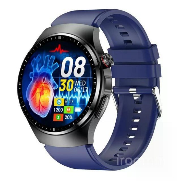 무채혈 혈당측정 무통 당뇨측정 요산 지질  건강 모니터링 스마트워치 통화 AI 음성