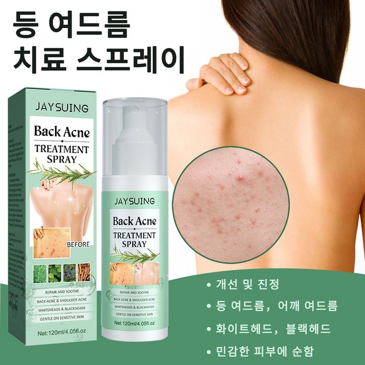 등드름 바디미스트 등여드름몸여드름가슴여드름 천연 식물 성분