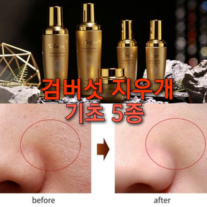 검버섯지우게 5종 세트고흡수 아데노신 기능성스킨케어, 1개